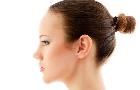 otoplastia mujeres